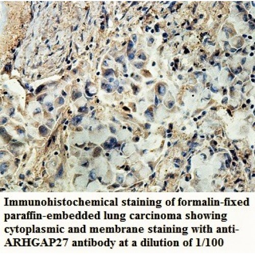 ARHGAP27 Antibody