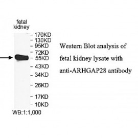 ARHGAP28 Antibody