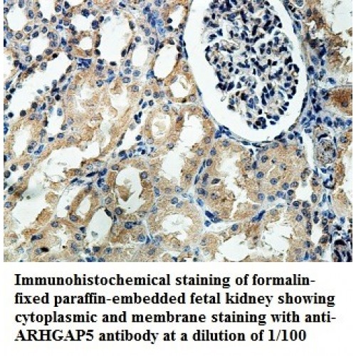 ARHGAP5 Antibody