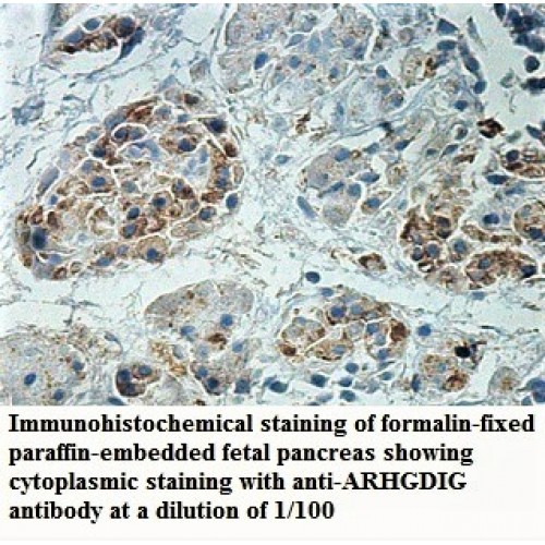 ARHGDIG Antibody