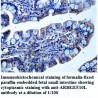 ARHGEF10L Antibody