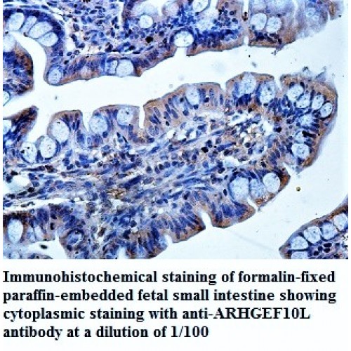 ARHGEF10L Antibody
