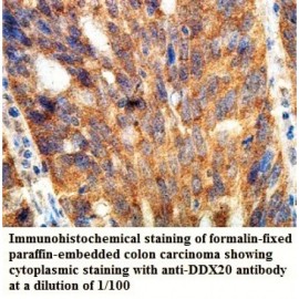 DDX20 Antibody
