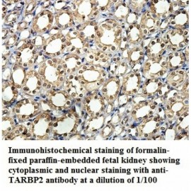 TARBP2 Antibody