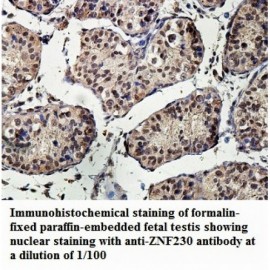 ZNF230 Antibody