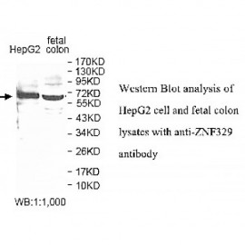 ZNF329 Antibody