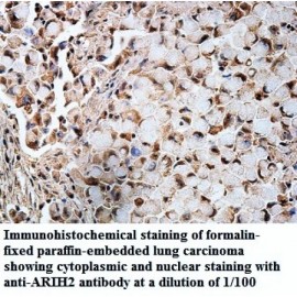 ARIH2 Antibody