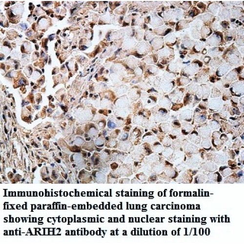 ARIH2 Antibody