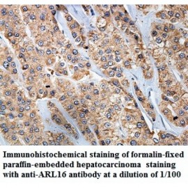 ARL16 Antibody