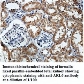 ARL6 Antibody