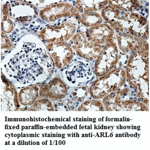 ARL6 Antibody