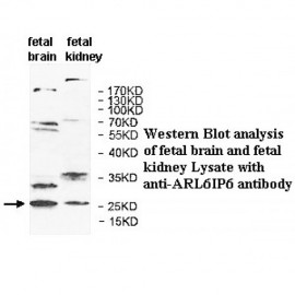 ARL6IP6 Antibody
