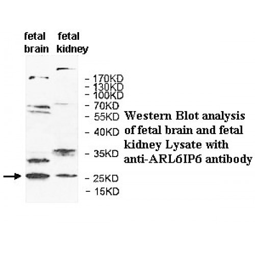 ARL6IP6 Antibody