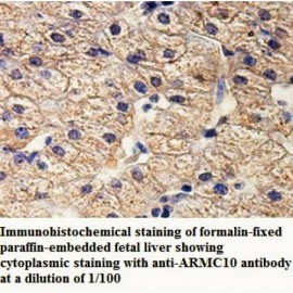 ARMC10 Antibody