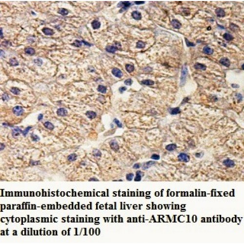 ARMC10 Antibody