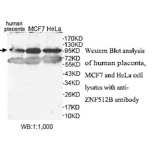 ZNF512B Antibody