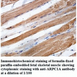 ARPC1A Antibody