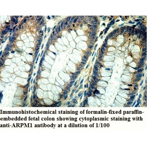 ARPM1 Antibody