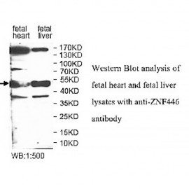 ZNF446 Antibody