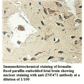 ZNF471 Antibody