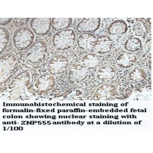 ZNF555 Antibody