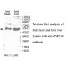 ZNF556 Antibody