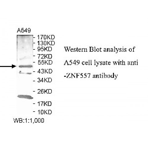 ZNF557 Antibody