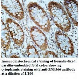 ZNF566 Antibody