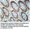 ZNF566 Antibody