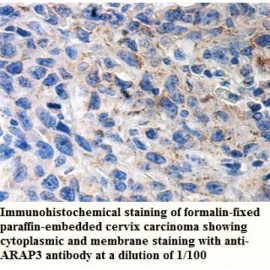 ARAP3 Antibody