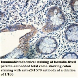 ZNF570 Antibody