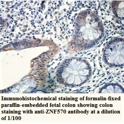 ZNF570 Antibody