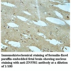 ZNF581 Antibody