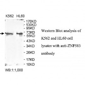 ZNF583 Antibody