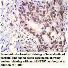 ZNF592 Antibody