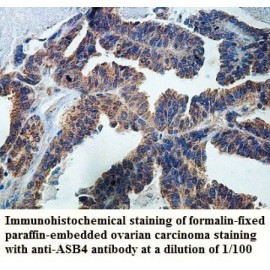 ASB4 Antibody