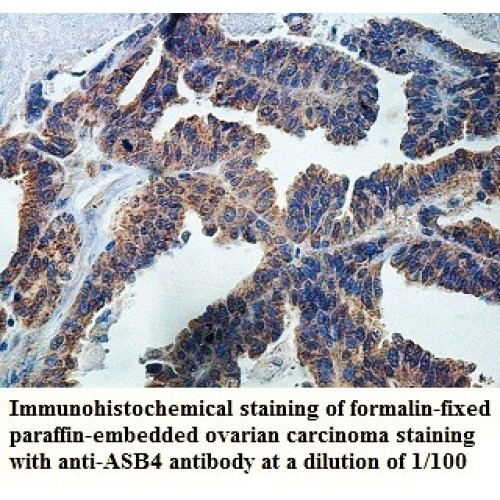 ASB4 Antibody