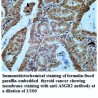 ASGR2 Antibody