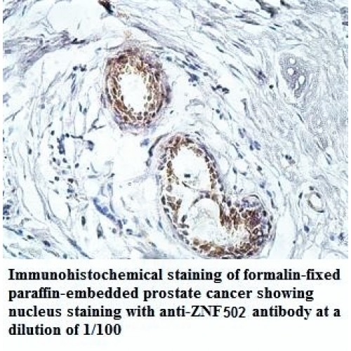 ZNF502 Antibody