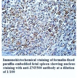 ZNF500 Antibody