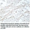 ZBTB49 Antibody