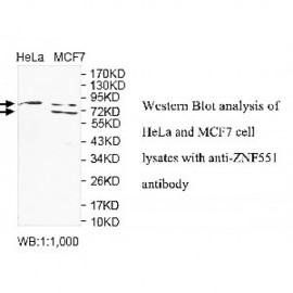 ZNF551 Antibody