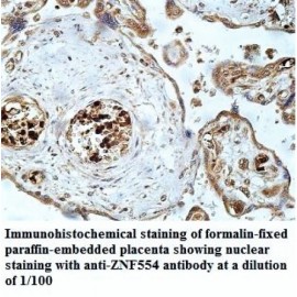 ZNF554 Antibody