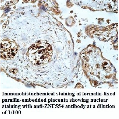 ZNF554 Antibody
