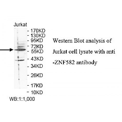 ZNF582 Antibody