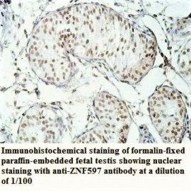 ZNF597 Antibody