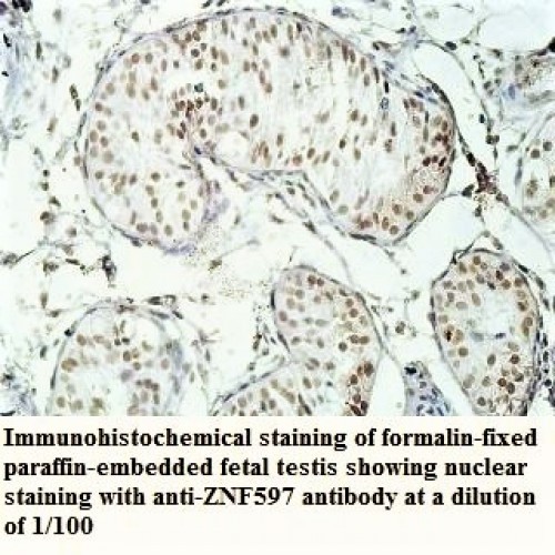 ZNF597 Antibody
