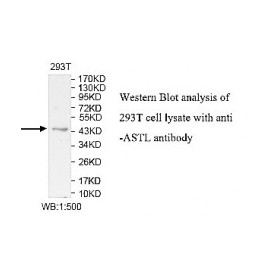 ZNF582 Antibody