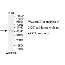 ZNF582 Antibody