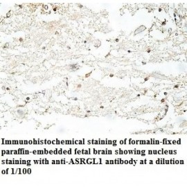ASRGL1 Antibody